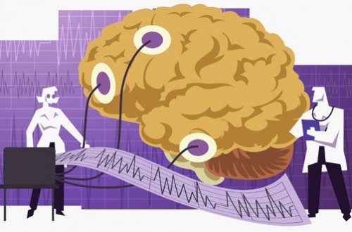 Електроенцефалограма на мозъка